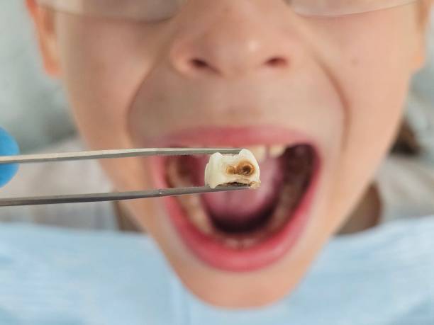 Best Knocked-Out Tooth Emergency  in San Marcos, CA
